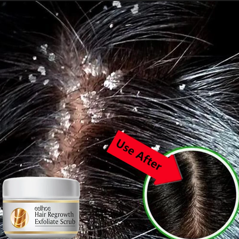 Scalp Scrub Exfoliant - Быстродействующий скраб для волос против перхоти,