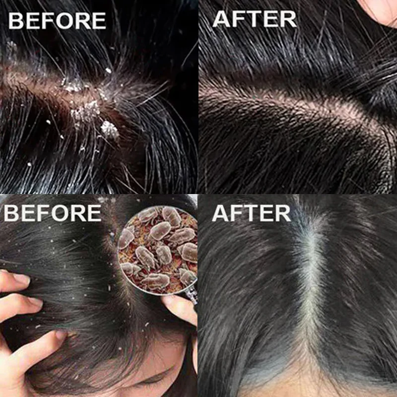 Быстродействующий скраб для во – обзор и цена Scalp Scrub Exfoliant