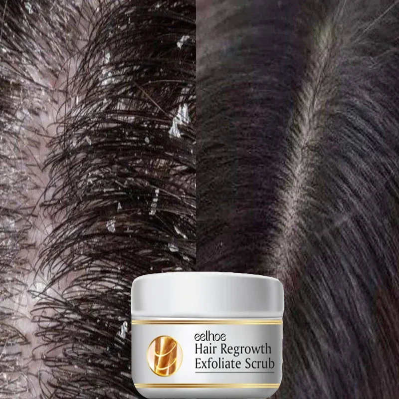 Быстродействующий скраб для во – обзор и цена Scalp Scrub Exfoliant